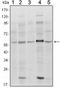 SMAD Family Member 4 antibody, LS-C171509, Lifespan Biosciences, Western Blot image 