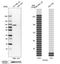 Procollagen-Lysine,2-Oxoglutarate 5-Dioxygenase 3 antibody, HPA001236, Atlas Antibodies, Western Blot image 