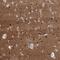 NLR Family Pyrin Domain Containing 10 antibody, NBP1-85557, Novus Biologicals, Immunohistochemistry paraffin image 