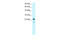 Regulator Of G Protein Signaling 20 antibody, 27-992, ProSci, Western Blot image 