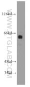 Fukutin antibody, 18276-1-AP, Proteintech Group, Western Blot image 