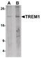 Triggering Receptor Expressed On Myeloid Cells 1 antibody, PA5-34500, Invitrogen Antibodies, Western Blot image 