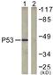 p53 antibody, LS-B7722, Lifespan Biosciences, Western Blot image 