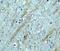 Beta-Secretase 1 antibody, GTX17545, GeneTex, Immunohistochemistry paraffin image 