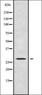 Centrosomal Protein 41 antibody, orb338158, Biorbyt, Western Blot image 