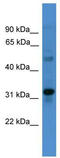 Transmembrane Protein 176B antibody, TA346477, Origene, Western Blot image 