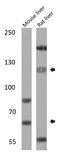 Sterol Regulatory Element Binding Transcription Factor 1 antibody, GTX79299, GeneTex, Western Blot image 