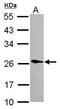Phospholipase A2 Group XIIA antibody, PA5-30867, Invitrogen Antibodies, Western Blot image 