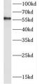 Deleted In Azoospermia 4 antibody, FNab02250, FineTest, Western Blot image 