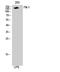 Kinase Insert Domain Receptor antibody, STJ93087, St John