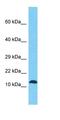 Retrotransposon Gag Like 8A antibody, orb327169, Biorbyt, Western Blot image 