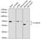 WASP Like Actin Nucleation Promoting Factor antibody, GTX32762, GeneTex, Western Blot image 