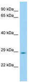 Hes Family BHLH Transcription Factor 6 antibody, TA331840, Origene, Western Blot image 