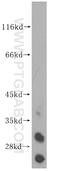WD Repeat Domain 4 antibody, 14766-1-AP, Proteintech Group, Western Blot image 