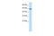 SET1 antibody, 28-031, ProSci, Western Blot image 