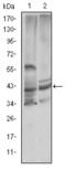 Cystatin C antibody, STJ97981, St John