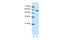 Coronin 1A antibody, 28-045, ProSci, Western Blot image 