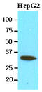 Carbonyl Reductase 3 antibody, MBS200168, MyBioSource, Western Blot image 