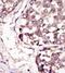 Receptor Like Tyrosine Kinase antibody, GTX25518, GeneTex, Immunohistochemistry paraffin image 