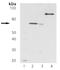 Zeta Chain Of T Cell Receptor Associated Protein Kinase 70 antibody, M00754, Boster Biological Technology, Western Blot image 