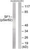 Mammalian branch point-binding protein antibody, 79-794, ProSci, Western Blot image 