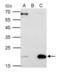 SRI antibody, GTX106105, GeneTex, Immunoprecipitation image 