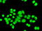 Checkpoint Kinase 2 antibody, GTX84685, GeneTex, Immunofluorescence image 