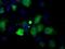 Profilin 1 antibody, GTX83903, GeneTex, Immunocytochemistry image 