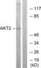 AKT Serine/Threonine Kinase 2 antibody, LS-C118043, Lifespan Biosciences, Western Blot image 