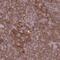 Oxidoreductase NAD Binding Domain Containing 1 antibody, NBP2-32435, Novus Biologicals, Immunohistochemistry paraffin image 