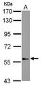 DEAF1 Transcription Factor antibody, GTX115430, GeneTex, Western Blot image 