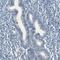 Cytochrome P450 Family 2 Subfamily E Member 1 antibody, NBP1-85367, Novus Biologicals, Immunohistochemistry paraffin image 