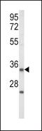 Insulin Like Growth Factor Binding Protein 2 antibody, PA5-35343, Invitrogen Antibodies, Western Blot image 