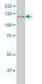 Phospholipase C Gamma 1 antibody, H00005335-M01, Novus Biologicals, Western Blot image 