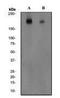 Glutamate Ionotropic Receptor NMDA Type Subunit 2B antibody, GTX62089, GeneTex, Western Blot image 