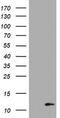 S100 Calcium Binding Protein B antibody, TA801095, Origene, Western Blot image 