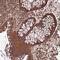 Protein Only RNase P Catalytic Subunit antibody, HPA020459, Atlas Antibodies, Immunohistochemistry frozen image 