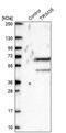 Tripartite Motif Containing 35 antibody, PA5-54042, Invitrogen Antibodies, Western Blot image 