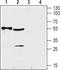 Solute Carrier Family 29 Member 2 antibody, TA328910, Origene, Western Blot image 