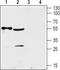 Solute Carrier Family 29 Member 2 antibody, TA328910, Origene, Western Blot image 