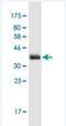 Synaptotagmin 7 antibody, H00009066-M01-100ug, Novus Biologicals, Western Blot image 