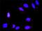 Casein Kinase 2 Alpha 1 antibody, H00001457-M01, Novus Biologicals, Proximity Ligation Assay image 