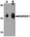 Aldehyde Dehydrogenase 5 Family Member A1 antibody, TA306648, Origene, Western Blot image 
