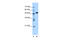 Aat1 antibody, 30-105, ProSci, Enzyme Linked Immunosorbent Assay image 