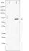 Spleen Associated Tyrosine Kinase antibody, abx011580, Abbexa, Western Blot image 