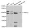 Protein Kinase C Epsilon antibody, abx001722, Abbexa, Western Blot image 