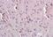 Cell Migration Inducing Hyaluronidase 2 antibody, orb2292, Biorbyt, Immunohistochemistry paraffin image 