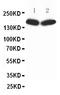 Nitric Oxide Synthase 1 antibody, PA1329, Boster Biological Technology, Western Blot image 