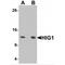 HIG1 Hypoxia Inducible Domain Family Member 1A antibody, MBS151415, MyBioSource, Western Blot image 