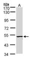 Activin A Receptor Like Type 1 antibody, NBP1-30982, Novus Biologicals, Western Blot image 